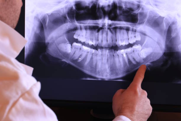 Best Emergency Dental Care for Broken or Chipped Teeth in Mission, KS
