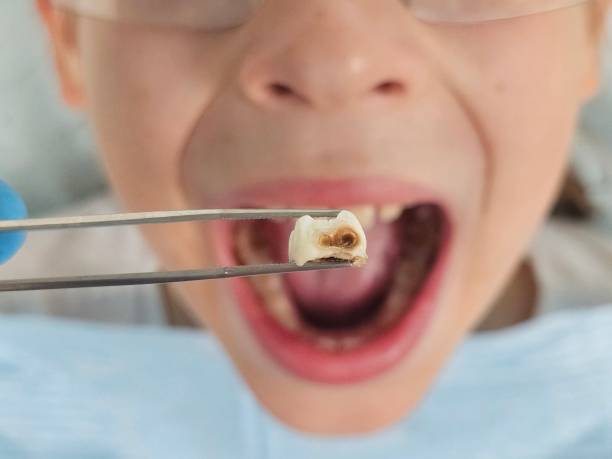 Best Emergency Denture Repair in Mission, KS